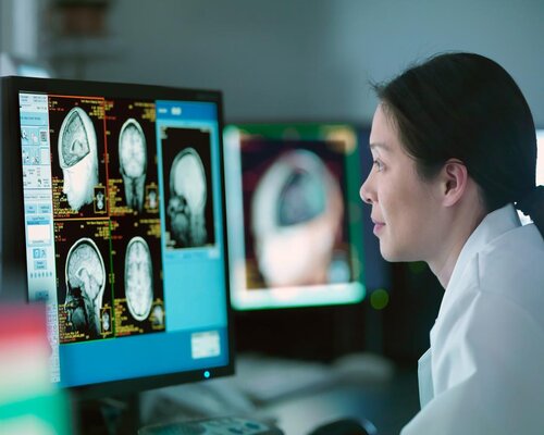 Neurology